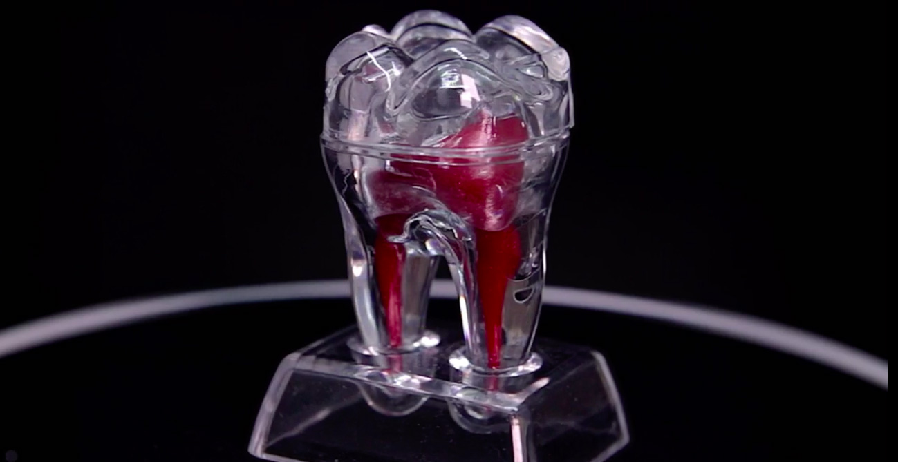 Лечение и пломбировка каналов зубов