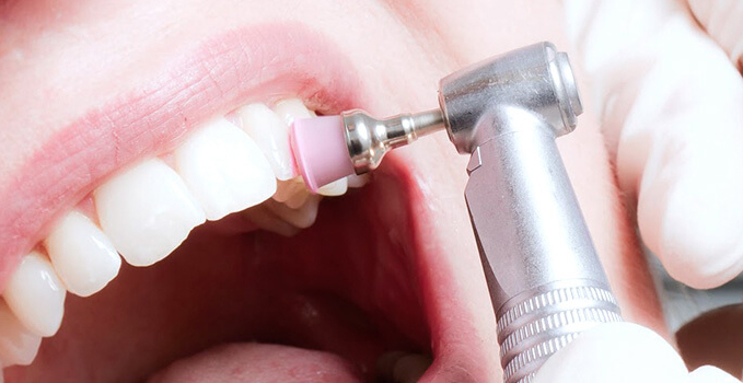 Комплексная чистка зубов у детей