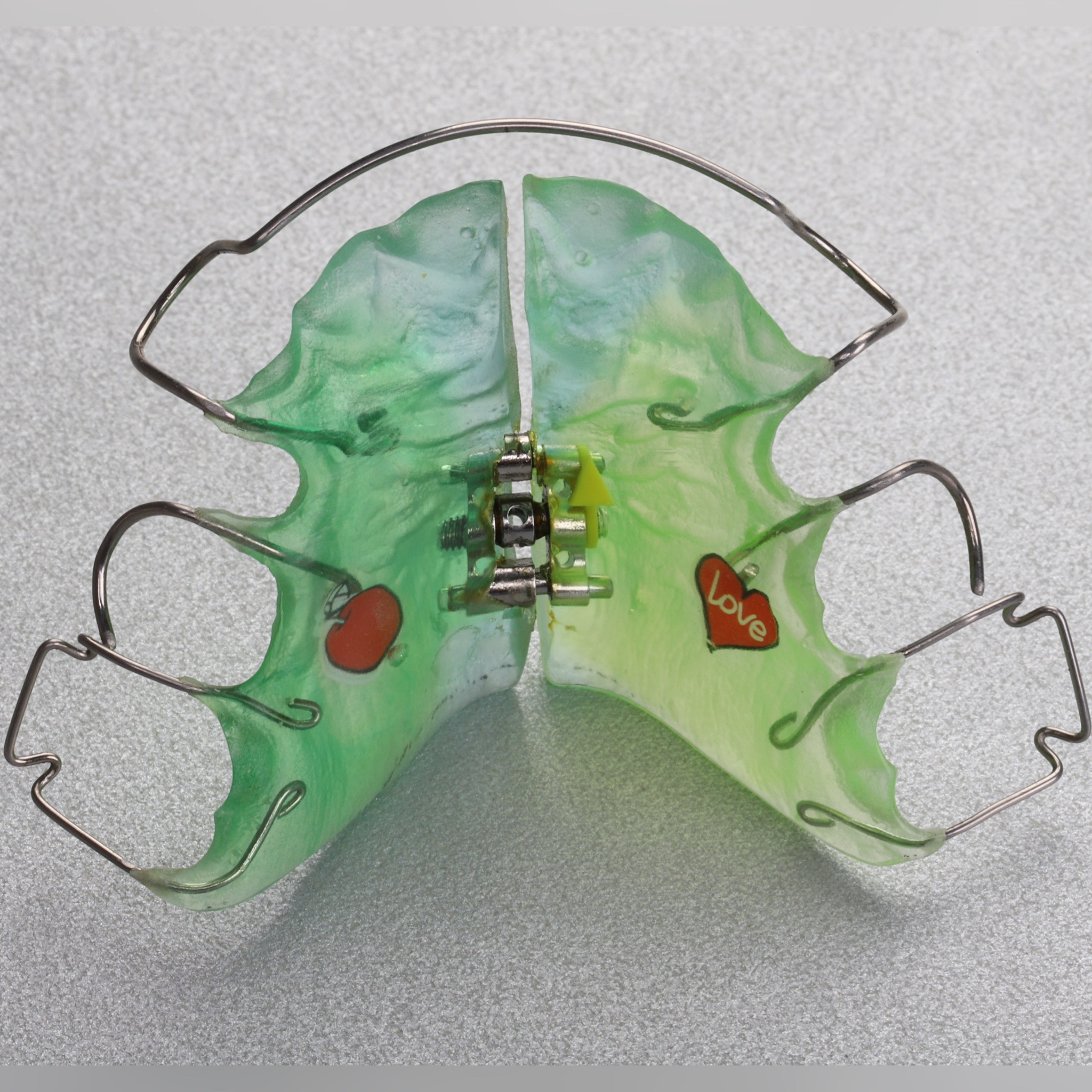 Пластинка ортодонтическая с винтом для расширения