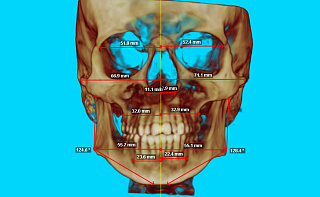 Компьютерная томография (3D)