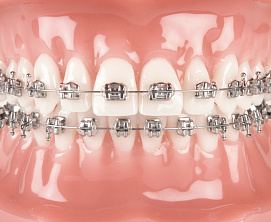 MASTER American Orthodontics